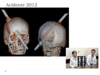 Acidente 2012
 