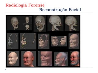 Radiologia Forense
Reconstrução Facial
 