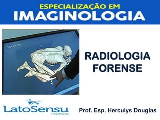 RADIOLOGIA
FORENSE
Prof. Esp. Herculys Douglas
 