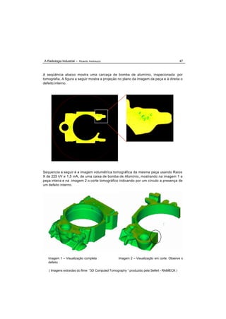 A Radiologia Industrial - Ricardo Andreucci                                                    47



A seqüência abaixo mostra uma carcaça de bomba de alumínio, inspecionada por
tomografia. A figura a seguir mostra a projeção no plano da imagem da peça e à direita o
defeito interno.




Sequencia a seguir é a imagem volumétrica tomográfica da mesma peça usando Raios
X de 225 kV e 1,5 mA, de uma caixa de bomba de Alumínio, mostrando na imagem 1 a
peça inteira e na imagem 2 o corte tomográfico indicando por um círculo a presença de
um defeito interno.




   Imagem 1 – Visualização completa                Imagem 2 – Visualização em corte. Observe o
   defeito

   ( Imagens extraídas do filme “3D Computed Tomography “ produzido pela Seifert - RAIMECK )
 