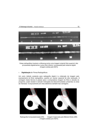 A Radiologia Industrial - Ricardo Andreucci                                               52




    Estas radiografias mostram a diferença entre uma imagem original (foto superior) não
       processada digitalmente e outra (foto inferior) processada pelo sistema digital
                                        (Imagens cedidas pela AGFA)



•       Digitalização de Filmes Radiográficos

Um outro método existente para radiografia digital é a obtenção da imagem pelo
scaneamento do filme radiográfico, usando um scaner especial de alta resolução. A
vantagem desta técnica é passar para o computadora imagem do filme e através do
programa, poder ampliar e estudar indicações de descontinuidades presentes na área
de interesse. O arquivamento em meio eletrônico também traz vantagens.




     Radiografia Computadorizada (CR)              Imagem Capturada pelo Método Direto (DR)
                                       ( Imagens cedidas para AGFA)
 