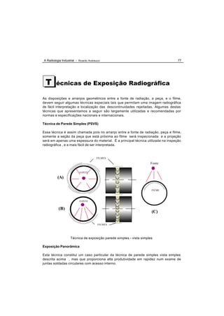 A Radiologia Industrial - Ricardo Andreucci                                       77




 T       écnicas de Exposição Radiográfica

As disposições e arranjos geométricos entre a fonte de radiação, a peça, e o filme,
devem seguir algumas técnicas especiais tais que permitam uma imagem radiográfica
de fácil interpretação e localização das descontinuidades rejeitadas. Algumas destas
técnicas que apresentamos a seguir são largamente utilizadas e recomendadas por
normas e especificações nacionais e internacionais.

Técnica de Parede Simples (PSVS)

Essa técnica é assim chamada pois no arranjo entre a fonte de radiação, peça e filme,
somente a seção da peça que está próxima ao filme será inspecionada e a projeção
será em apenas uma espessura do material. É a principal técnica utilizada na inspeção
radiográfica , e a mais fácil de ser interpretada.


                                        FILMES

                                                                     Fonte

                           FONTE

          (A)

                                                                      FILME



                           FONTE


           (B)
                                                                      (C)

                                         FILMES




                    Técnica de exposição parede simples - vista simples

Exposição Panorâmica

Esta técnica constitui um caso particular da técnica de parede simples vista simples
descrita acima , mas que proporciona alta produtividade em rapidez num exame de
juntas soldadas circulares com acesso interno.
 