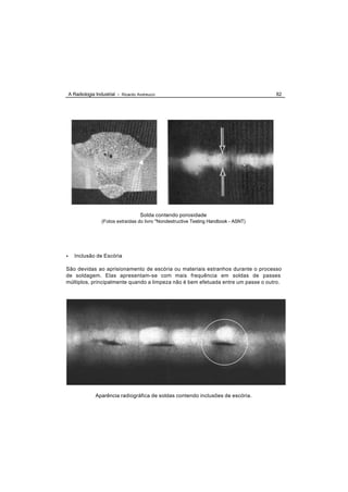 A Radiologia Industrial - Ricardo Andreucci                                          82




                                       Solda contendo porosidade
                    (Fotos extraídas do livro "Nondestructive Testing Handbook - ASNT)




•      Inclusão de Escória

São devidas ao aprisionamento de escória ou materiais estranhos durante o processo
de soldagem. Elas apresentam-se com mais frequência em soldas de passes
múltiplos, principalmente quando a limpeza não é bem efetuada entre um passe o outro.




                 Aparência radiográfica de soldas contendo inclusões de escória.
 