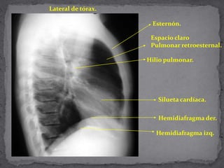 Lateral de tórax.
Esternón.
Espacio claro
Pulmonar retroesternal.
Hilio pulmonar.
Silueta cardíaca.
Hemidiafragma der.
Hemidiafragma izq.
 