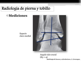 Angulo Tobillo Radiologia pierna y tobillo | PDF