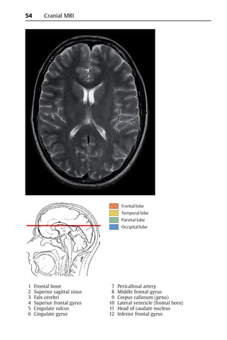 Pocket-atlas-of-sectional-anatomy-Vol-1-2-64-320.jpg