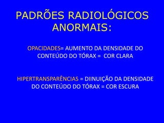 PADRÕES RADIOLÓGICOS
ANORMAIS:
OPACIDADES= AUMENTO DA DENSIDADE DO
CONTEÚDO DO TÓRAX = COR CLARA
HIPERTRANSPARÊNCIAS = DIINUIÇÃO DA DENSIDADE
DO CONTEÚDO DO TÓRAX = COR ESCURA
 