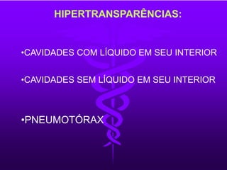 HIPERTRANSPARÊNCIAS:
•CAVIDADES COM LÍQUIDO EM SEU INTERIOR
•CAVIDADES SEM LÍQUIDO EM SEU INTERIOR
•PNEUMOTÓRAX
 