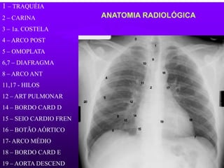 ANATOMIA RADIOLÓGICA
1 – TRAQUÉIA
2 – CARINA
3 – 1a. COSTELA
4 – ARCO POST
5 – OMOPLATA
6,7 – DIAFRAGMA
8 – ARCO ANT
11,17 - HILOS
12 – ART PULMONAR
14 – BORDO CARD D
15 – SEIO CARDIO FREN
16 – BOTÃO AÓRTICO
17- ARCO MÉDIO
18 – BORDO CARD E
19 – AORTA DESCEND
 