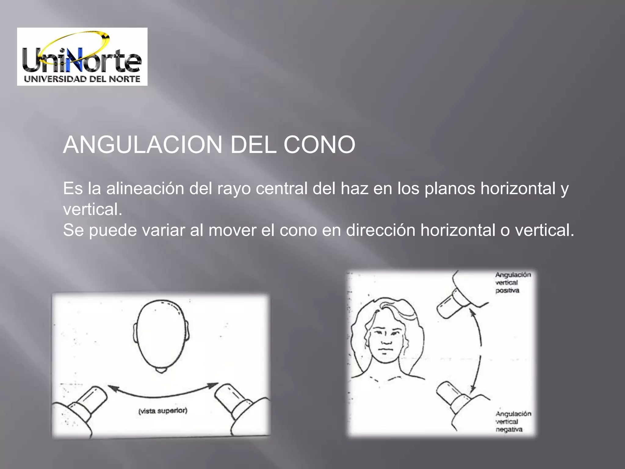 ANGULACION DEL CONO
Es la alineación del rayo central del haz en los planos horizontal y
vertical.
Se puede variar al mover el cono en dirección horizontal o vertical.
 