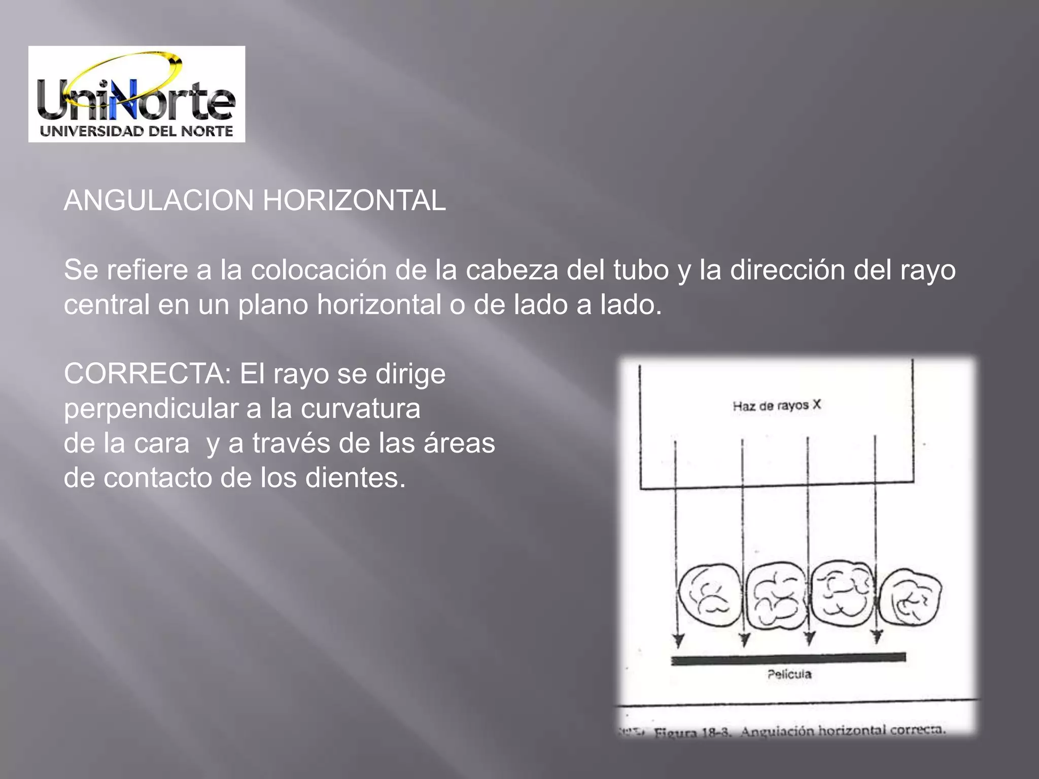 ANGULACION HORIZONTAL

Se refiere a la colocación de la cabeza del tubo y la dirección del rayo
central en un plano horizontal o de lado a lado.

CORRECTA: El rayo se dirige
perpendicular a la curvatura
de la cara y a través de las áreas
de contacto de los dientes.
 
