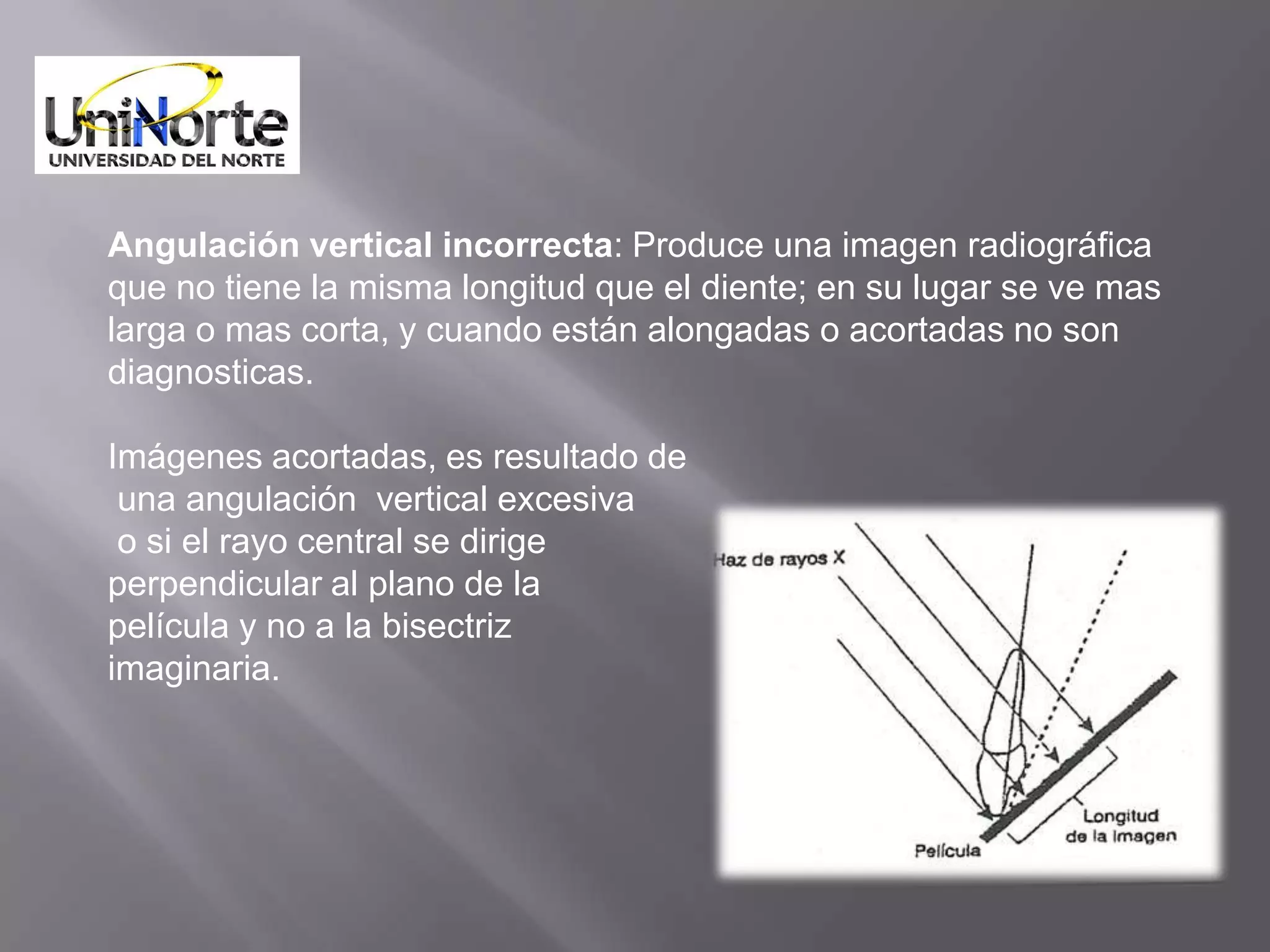 Angulación vertical incorrecta: Produce una imagen radiográfica
que no tiene la misma longitud que el diente; en su lugar se ve mas
larga o mas corta, y cuando están alongadas o acortadas no son
diagnosticas.

Imágenes acortadas, es resultado de
 una angulación vertical excesiva
 o si el rayo central se dirige
perpendicular al plano de la
película y no a la bisectriz
imaginaria.
 