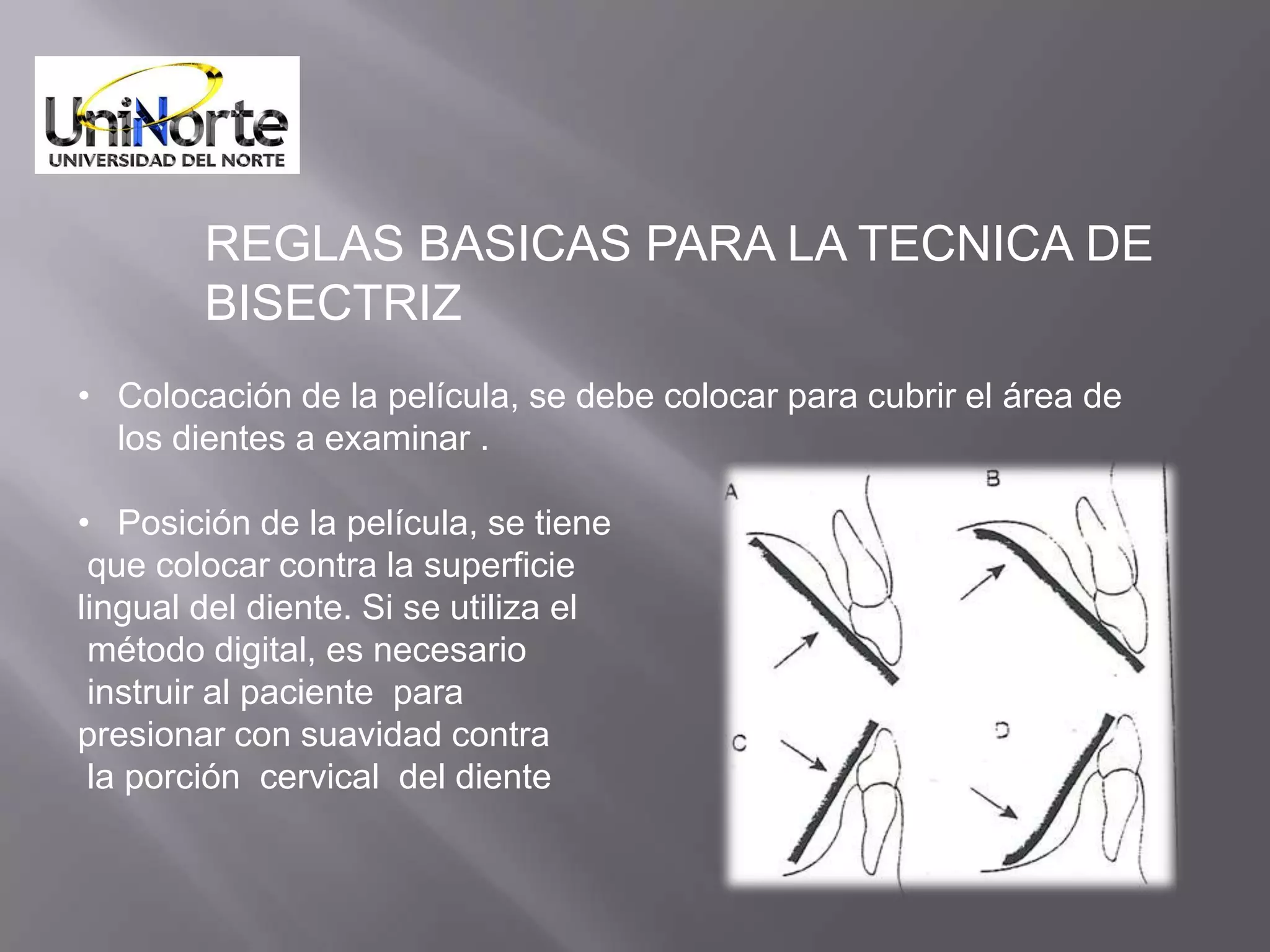REGLAS BASICAS PARA LA TECNICA DE
        BISECTRIZ
• Colocación de la película, se debe colocar para cubrir el área de
  los dientes a examinar .

• Posición de la película, se tiene
 que colocar contra la superficie
lingual del diente. Si se utiliza el
 método digital, es necesario
 instruir al paciente para
presionar con suavidad contra
 la porción cervical del diente
 