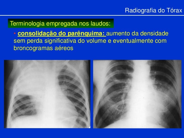 Resultado de imagem para rx com laudo