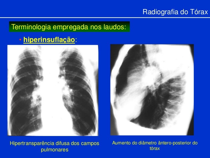 Resultado de imagem para rx com laudo
