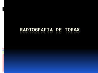 RADIOGRAFIA DE TORAX
 