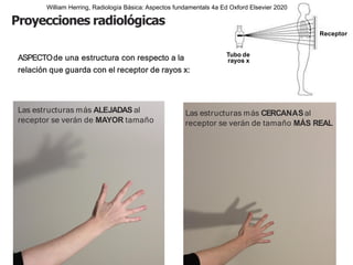Proyecciones radiológicas
ASPECTOde una estructura con respecto a la
relación que guarda con el receptor de rayos x:
Tubo de
rayos x
Receptor
Las estructuras más ALEJADAS al
receptor se verán de MAYOR tamaño
Las estructuras más CERCANASal
receptor se verán de tamaño MÁS REAL
William Herring, Radiología Básica: Aspectos fundamentals 4a Ed Oxford Elsevier 2020
 