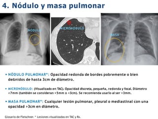 iDESIGN
by HiSlide.io
4. Nódulo y masa pulmonar
• NÓDULO PULMONAR*: Opacidad redonda de bordes pobremente o bien
deﬁnidos de hasta 3cm de diámetro.
• MICRONÓDULO: (Visualizado en TAC). Opacidad discreta, pequeña, redonda y focal. Diámetro
<7mm (también se consideran <5mm o <3cm). Se recomienda usarlo al ser <3mm.
• MASA PULMONAR*: Cualquier lesión pulmonar, pleural o mediastinal con una
opacidad >3cm en diámetro.
Glosario de Fleischner. * Lesiones visualizadas en TAC y Rx.
NÓDULO
M ICRONÓDULO
MASA
 