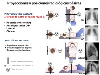 iDESIGN
by HiSlide.io
Proyecciones y posiciones radiológicas básicas
PROYECCIONES BÁSICAS
¿Por donde entra el haz de rayos x?
• Posterioanterior (PA)
• Anteroposterior (AP)
• Lateral
• Oblicua
POSICIÓN DEL PACIENTE
• Bipedestación (de pie)
• Decúbito (prono o supino)
• En sedestación (sentado)
Chasís (cassette radiológico)
Dirección de haz de rayos x
Tubo de rayos x
PA
AP
Lateral
Oblicua
 