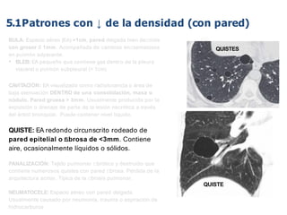 iDESIGN
by HiSlide.io
QUISTE
QUISTES
BULA: Espacio aéreo (EA) >1cm, pared delgada bien deﬁnida
con grosor ≤ 1mm. Acompañada de cambios enﬁsematosos
en pulmón adyacente.
• BLEB: EA pequeño que contiene gas dentro de la pleura
visceral o pulmón subpleural (< 1cm)
CAVITACIÓN: EA visualizado como radiolucencia o área de
baja atenuación DENTRO de una consolidación, masa o
nódulo. Pared gruesa > 3mm. Usualmente producida por la
expulsión o drenaje de parte de la lesión necrótica a través
del árbol bronquial. Puede contener nivel líquido.
QUISTE: EA redondo circunscrito rodeado de
pared epitelial o ﬁbrosa de <3mm. Contiene
aire, ocasionalmente líquidos o sólidos.
PANALIZACIÓN: Tejido pulmonar ﬁbrótico y destruído que
contiene numerosos quistes con pared ﬁbrosa. Pérdida de la
arquitectura acinar. Típica de la ﬁbrosis pulmonar.
NEUMATOCELE: Espacio aéreo con pared delgada.
Usualmente causado por neumonía, trauma o aspiración de
hidrocarburos
5.1Patrones con ↓ de la densidad (con pared)
 