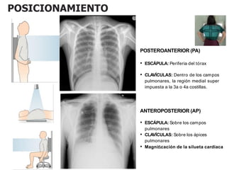 POSICIONAMIENTO
POSTEROANTERIOR (PA)
• ESCÁPULA: Periferia del tórax
• CLAVÍCULAS: Dentro de los campos
pulmonares, la región medial super
impuesta a la 3a o 4a costillas.
ANTEROPOSTERIOR (AP)
• ESCÁPULA: Sobre los campos
pulmonares
• CLAVÍCULAS: Sobre los ápices
pulmonares
• Magniﬁcación de la silueta cardiaca
 