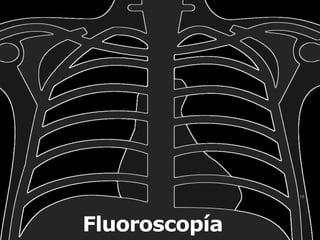 18
Fluoroscopía
 
