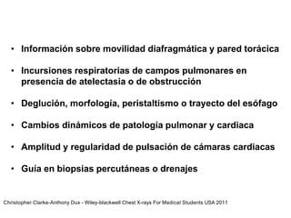 • Información sobre movilidad diafragmática y pared torácica
• Incursiones respiratorias de campos pulmonares en
presencia de atelectasia o de obstrucción
• Deglución, morfología, peristaltismo o trayecto del esófago
• Cambios dinámicos de patología pulmonar y cardiaca
• Amplitud y regularidad de pulsación de cámaras cardiacas
• Guía en biopsias percutáneas o drenajes
Christopher Clarke-Anthony Dux - Wiley-blackwell Chest X-rays For Medical Students USA 2011
 