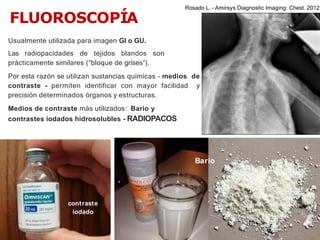 iDESIGN
by HiSlide.io
FLUOROSCOPÍA
Usualmente utilizada para imagen GI o GU.
Las radiopacidades de tejidos blandos son
prácticamente similares (“bloque de grises”).
Por esta razón se utilizan sustancias químicas - medios de
contraste - permiten identificar con mayor facilidad y
precisión determinados órganos y estructuras.
Medios de contraste más utilizados: Bario y
contrastes iodados hidrosolubles - RADIOPACOS
contraste
iodado
Bario
Rosado L. - Amirsys Diagnostic Imaging: Chest. 2012
 