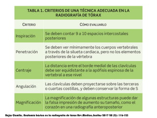 Rojas Camilo. Anatomía básica en la radiografía de tórax Rev.Medica.Sanitas 2017 20 (2): 116-123
 