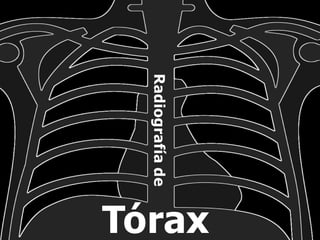 Radiografía
de
Tórax
 