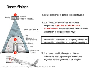 iDESIGN
by HiSlide.io
Bases físicas
1. El tubo de rayos x genera fotones (rayos x)
2. Los rayos x atraviesan las estructuras
corporales IONIZANDO MOLÉCULAS
CORPORALES y condicionando transmisión,
absorción y disipación del rayo
↑ atenuación ↑ densidad en imagen (más blanca)
↓ atenuación ↓ densidad en imagen (mas negra)
3. Los rayos x residuales que no fueron
atenuados son captados por detectores
digitales para la generación de imagen.
1
2
3
Ánodo
Cátodo
Tubo de Rayos X
Rayos de Rayos X
Piel
Músculo y
tejidos blandos
Hueso
Aire
Detector de
imagen
J. Vargas Romero . Aspectos básicos en radiología de tórax EB04-03 Radiología Madrid 2010
 