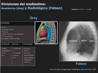Divisiones del mediastino:
Anatómica (Gray) y Radiológica (Felson)
SUPERIOR
• Aorta
• Grandes vasos
• Tráquea
• Tercio superior del esófago
• Timo superior
• Ganglios linfáticos (GL)
ANTERIOR MEDIO POSTERIOR
• Grasa
mediastinal
• Timo
• GL
• Pericardio
y
contenido
• Carina
• GL
• Esófago
• Aorta
torácica
descendente
• Vena ácigos
• Conducto
torácico
ANTERIOR MEDIO POST
Gray
Felson
Radiology: Vol. 272: No. 1—July 2014
Felson B. Chest roentgenology. Philadelphia: W.B. Saun-ders; 1973.
 
