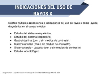 J. Vargas Romero . Aspectos básicos en radiología de tórax EB04-03 Radiología Madrid 2010
 