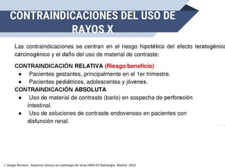 J. Vargas Romero . Aspectos básicos en radiología de tórax EB04-03 Radiología Madrid 2010
 