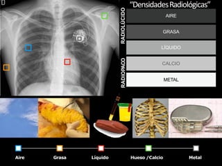 Grasa Líquido Hueso /Calcio
Aire Metal
AIRE
GRASA
LÍQUIDO
CALCIO
METAL
“DensidadesRadiológicas”
RADIOLÚCIDO
RADIOPACO
 