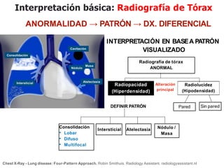 iDESIGN
by HiSlide.io
Consolidación
Intersticial
Nódulo
Masa
Atelectasia
Cavitación
Interpretación básica: Radiografía de Tórax
Radiografía de tórax
ANORMAL
Radiopacidad
(Hiperdensidad)
Radiolucidez
(Hipodensidad)
DEFINIR PATRÓN
Consolidación
• Lobar
• Difuso
• Multifocal
Intersticial Atelectasia Nódulo /
Masa
Pared Sin pared
Alteración
principal
ANORMALIDAD → PATRÓN → DX. DIFERENCIAL
INTERPRETACIÓN EN BASEA PATRÓN
VISUALIZADO
Chest X-Ray - Lung disease: Four-Pattern Approach. Robin Smithuis. Radiology Assistant. radiologyassistant.nl
 