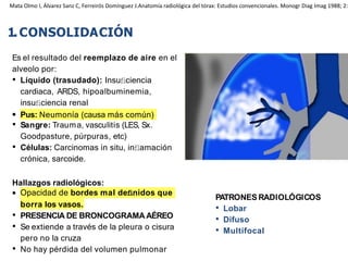 iDESIGN
by HiSlide.io
1.CONSOLIDACIÓN
Es el resultado del reemplazo de aire en el
alveolo por:
• Líquido (trasudado): Insuﬁciencia
cardiaca, ARDS, hipoalbuminemia,
insuﬁciencia renal
• Pus: Neumonía (causa más común)
• Sangre: Trauma, vasculitis (LES, Sx.
Goodpasture, púrpuras, etc)
• Células: Carcinomas in situ, inﬂamación
crónica, sarcoide.
Hallazgos radiológicos:
• Opacidad de bordes mal deﬁnidos que
borra los vasos.
• PRESENCIA DE BRONCOGRAMA AÉREO
• Se extiende a través de la pleura o cisura
pero no la cruza
• No hay pérdida del volumen pulmonar
PATRONES RADIOLÓGICOS
• Lobar
• Difuso
• Multifocal
Mata Olmo I, Álvarez Sanz C, Ferreirós Domínguez J.Anatomía radiológica del tórax: Estudios convencionales. Monogr Diag Imag 1988; 2:
 