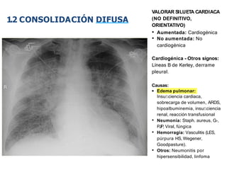 iDESIGN
by HiSlide.io
VALORAR SILUETA CARDIACA
(NO DEFINITIVO,
ORIENTATIVO)
• Aumentada: Cardiogénica
• No aumentada: No
cardiogénica
Cardiogénica - Otros signos:
Líneas B de Kerley, derrame
pleural.
Causas:
• Edema pulmonar:
Insuﬁciencia cardiaca,
sobrecarga de volumen, ARDS,
hipoalbuminemia, insuﬁciencia
renal, reacción transfusional
• Neumonía: Staph. aureus, G-,
PJP, Viral, fúngica
• Hemorragia: Vasculitis (LES,
púrpura HS, Wegener,
Goodpasture).
• Otros: Neumonitis por
hipersensibilidad, linfoma
1.2 CONSOLIDACIÓN DIFUSA
 