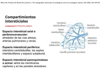 Compartimientos
intersticiales
Espacio intersticial axial o
peribroncovascular:
alrededor de las vías aéreas,
arterias pulmonares y venas.
Espacio intersticial periférico:
intersticio centrilobulillar, los septos
interlobulillares y espacio subpleural.
Espacio intersticial parenquimatoso
o acinar: entre las membranas
capilares y en las paredes alveolares.
Milne EN, Pistolesi M, Miniati M, Giuntini C. The radiographic distinction of cardiogenic and non-cardiogenic edema. AJR 1985; 144: 879-94.
 