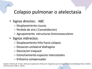 Cepeda T, Pedrosa CS. El tórax: Técnicas de exploración: Pedrosa CS. Diagnóstico por la Imagen. Tratado de Radiología Clínica. Madrid:
Interamericana; 1986. p. 103-28.
 