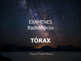 EXAMENES
Radiológicos
TÓRAX
Emmanuel Peralta Mendoza
 