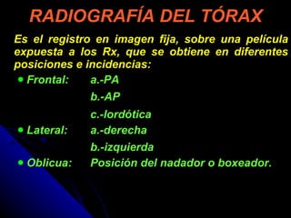 RADIOGRAFÍA DEL TÓRAX Es el registro en imagen fija, sobre una película expuesta a los Rx, que se obtiene en diferentes posiciones e incidencias: Frontal:  a.-PA    b.-AP c.-lordótica Lateral:  a.-derecha   b.-izquierda Oblicua:  Posición del nadador o boxeador.  