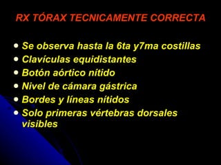 RX TÓRAX TECNICAMENTE CORRECTA Se observa hasta la 6ta y7ma costillas Clavículas equidistantes Botón aórtico nítido Nivel de cámara gástrica Bordes y líneas nítidos Solo primeras vértebras dorsales visibles 