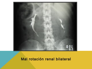 Radiologia Urológica | PPT
