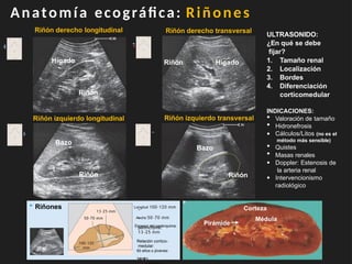 RADIOLOGIA UROLOGIA ECOGRAFIA RENAL Y TOMOGRAFIA | PPTX