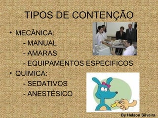 TIPOS DE CONTENÇÃO
• MECÂNICA:
- MANUAL
- AMARAS
- EQUIPAMENTOS ESPECIFICOS
• QUIMICA:
- SEDATIVOS
- ANESTÉSICO
By Helson Silveira
 