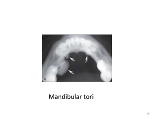 Radiology in oral & maxillofacial surgery | PPTX