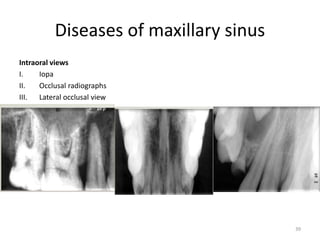 Radiology in oral & maxillofacial surgery | PPTX