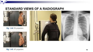 Vertical Radiograph Radiological anatomy | PPTX