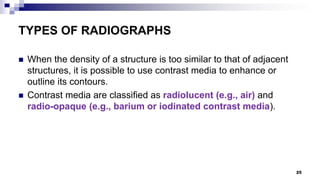 Radiological anatomy | PPTX
